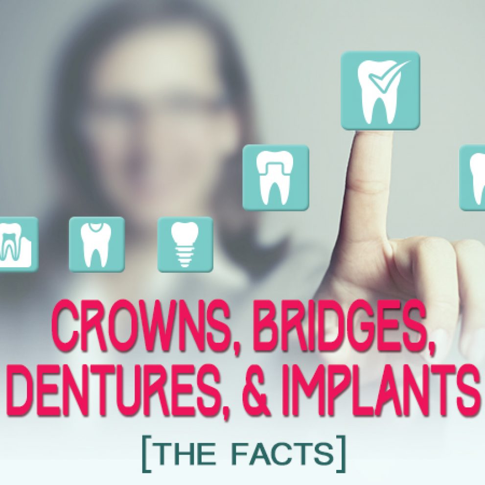Newport Beach dentist, Dr. Justin Hsieh, tells you about dental implants, crowns, bridges, and dentures at Birch Dental.