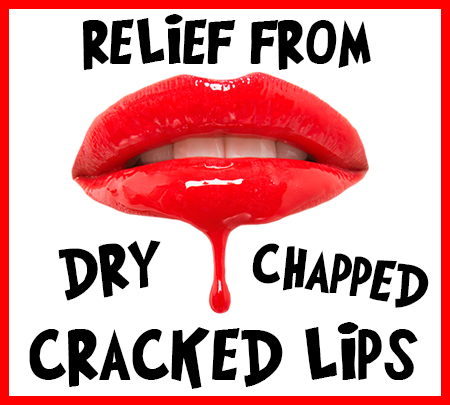 Newport Beach dentist, Dr. Justin Hsieh at Birch Dental, tells you how to relieve your dry, chapped, and cracked lips!