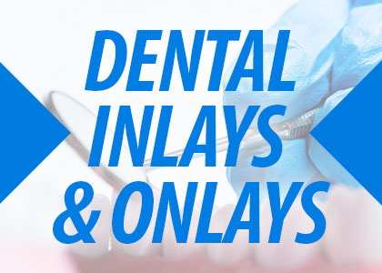 Newport Beach dentist, Dr. Justin Hsieh at Birch Dental shares all you need to know about inlays and onlays to repair damaged teeth in form and function.