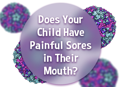 Newport Beach dentist, Dr. Justin Hsieh at Birch Dental tells parents about a common viral infection that may present with sores in your child’s mouth.