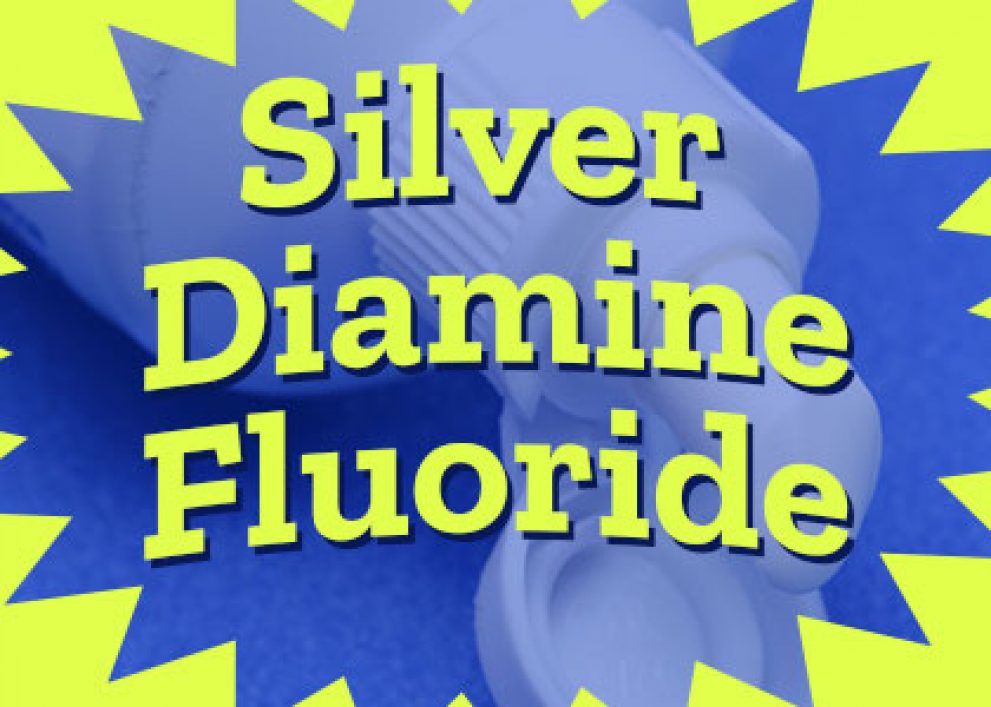 Newport Beach dentist, Dr. Justin Hsieh, of Birch Dental discusses silver diamine fluoride as a cavity fighter that helps patients—especially pediatric patients—avoid the dental drill.