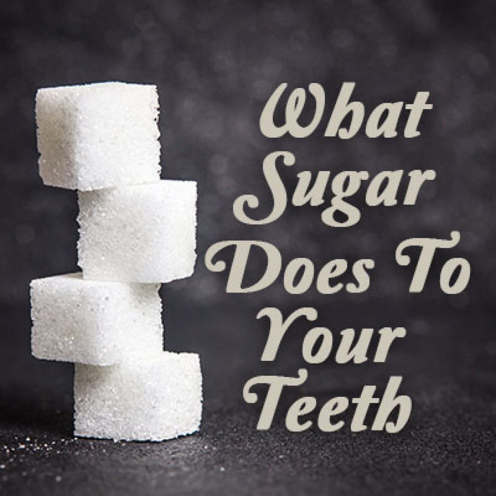 Newport Beach dentist, Dr. Justin Hsieh at Birch Dental shares exactly what sugar does to your teeth and how to prevent tooth decay.